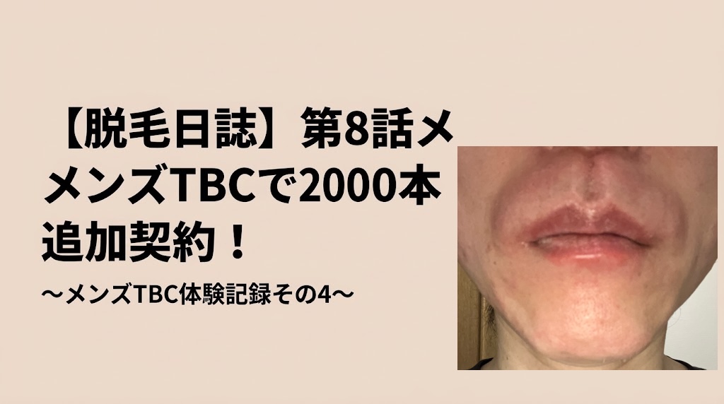 【脱毛日誌】第8話メンズTBCで2000本追加契約！～メンズTBC体験記録その4～