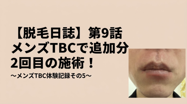 【脱毛日誌】第9話メンズTBCで追加分2回目の施術！～メンズTBC体験記録その5～